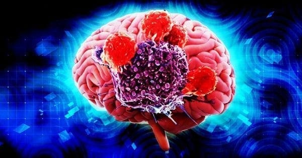 Functional Medicine – Neurological Health
