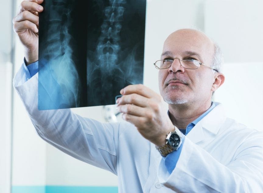 Degenerative Disc Disease Caused by Aging