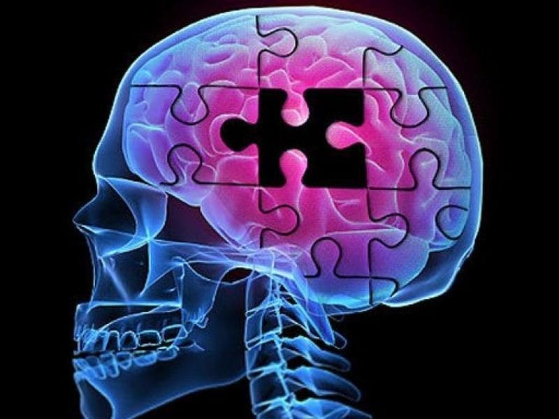 Tests Should Be Required Before Using Alzheimer’s Drugs