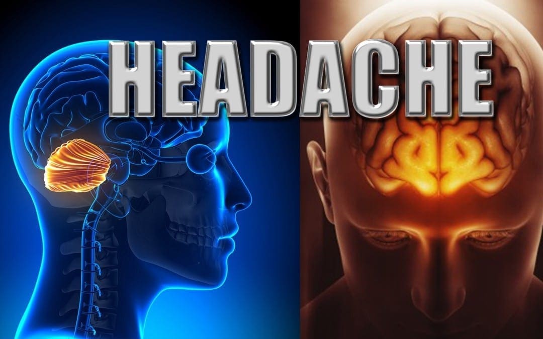 Origin Of Head Pain | El Paso, TX.