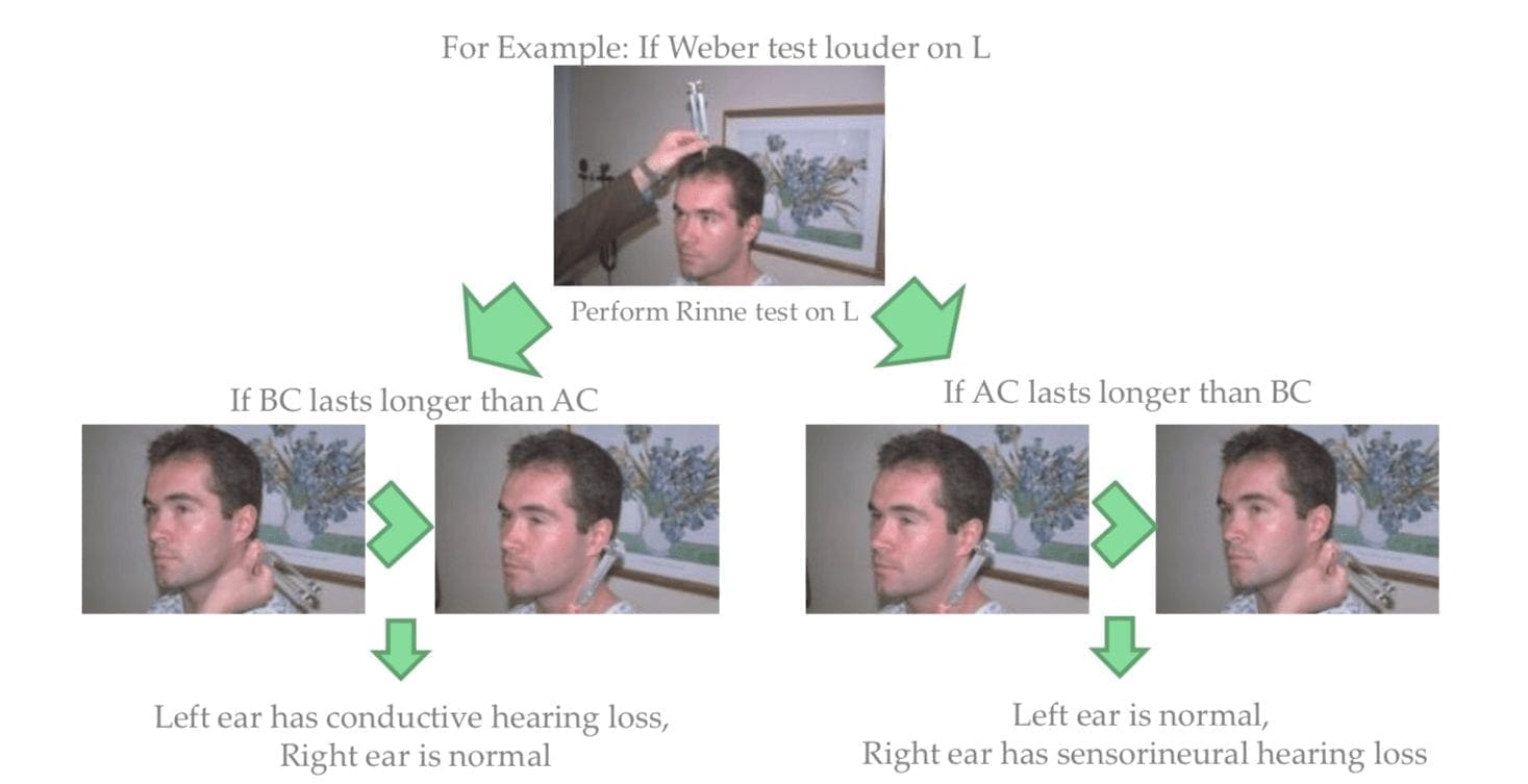 Testing Cranial Nerve VIII | El Paso, TX Chiropractor
