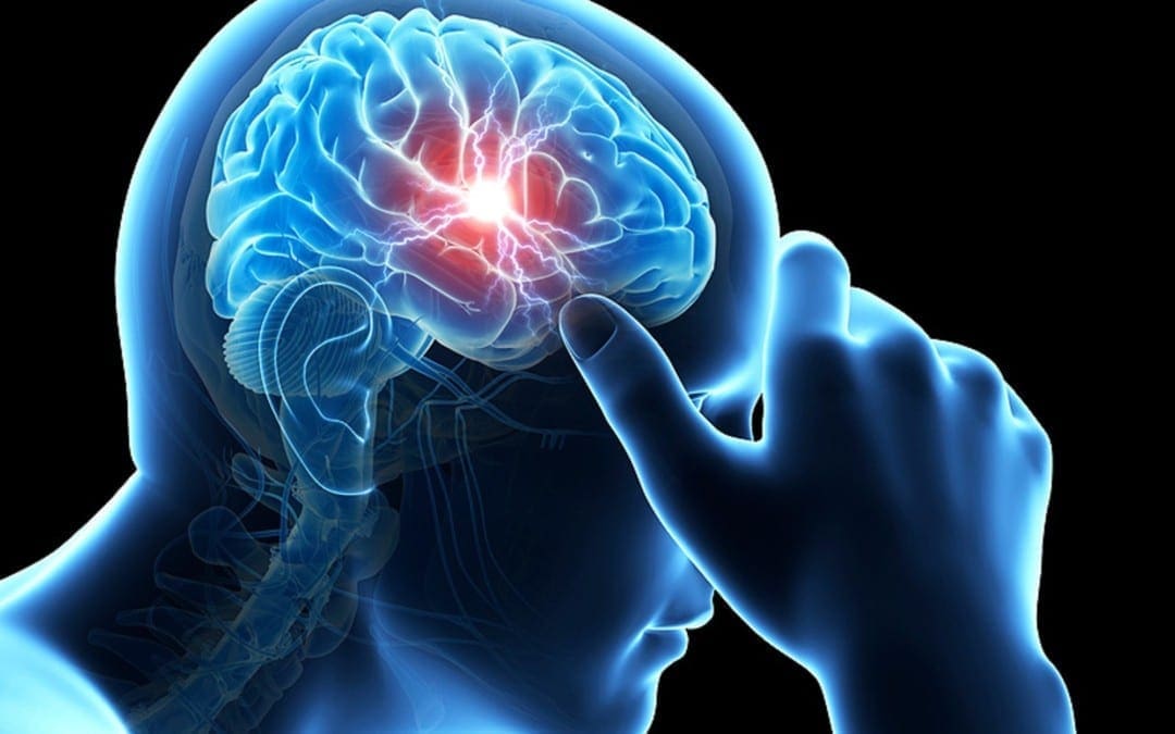 Understanding Chronic Pain Syndrome