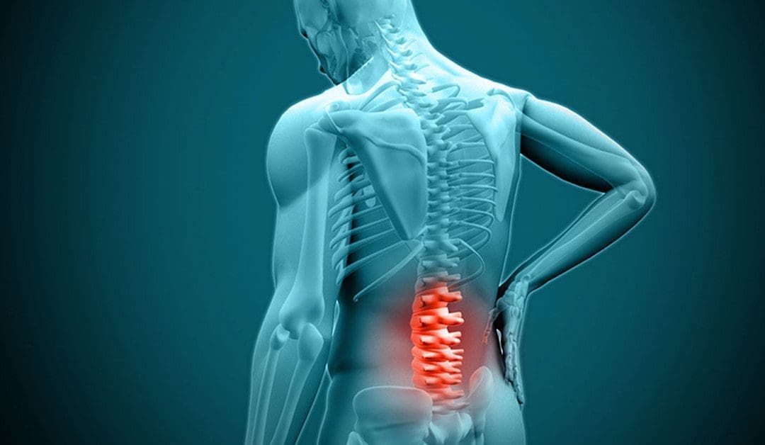 Non-Surgical Spinal Decompression For Chronic Low Back Pain