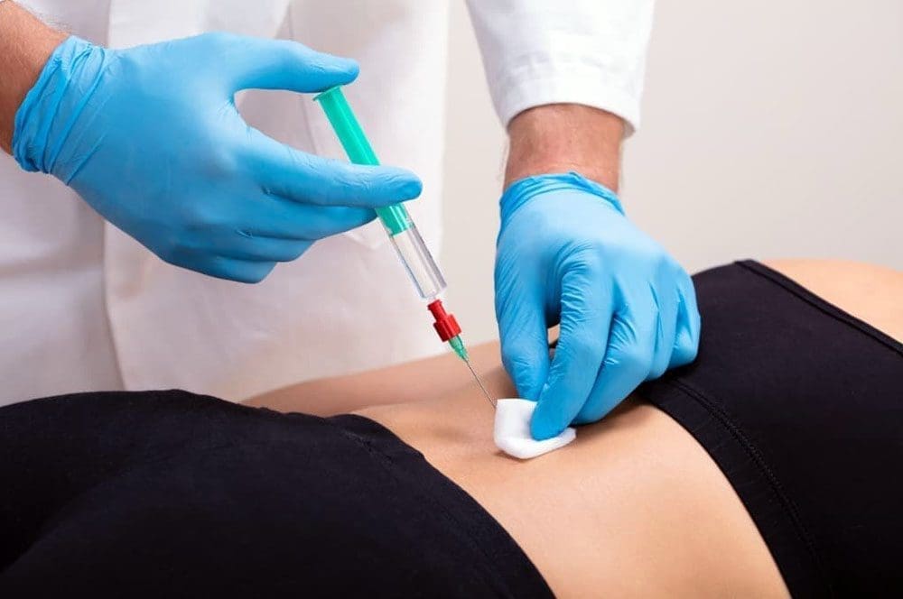 Natural Recovery Without Surgery: A New Approach