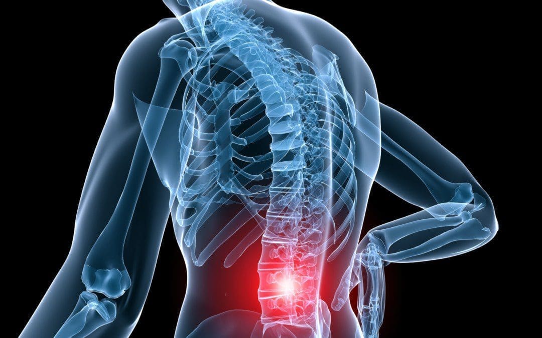 A Cost-Effective Treatment For Lumbosacral Pain