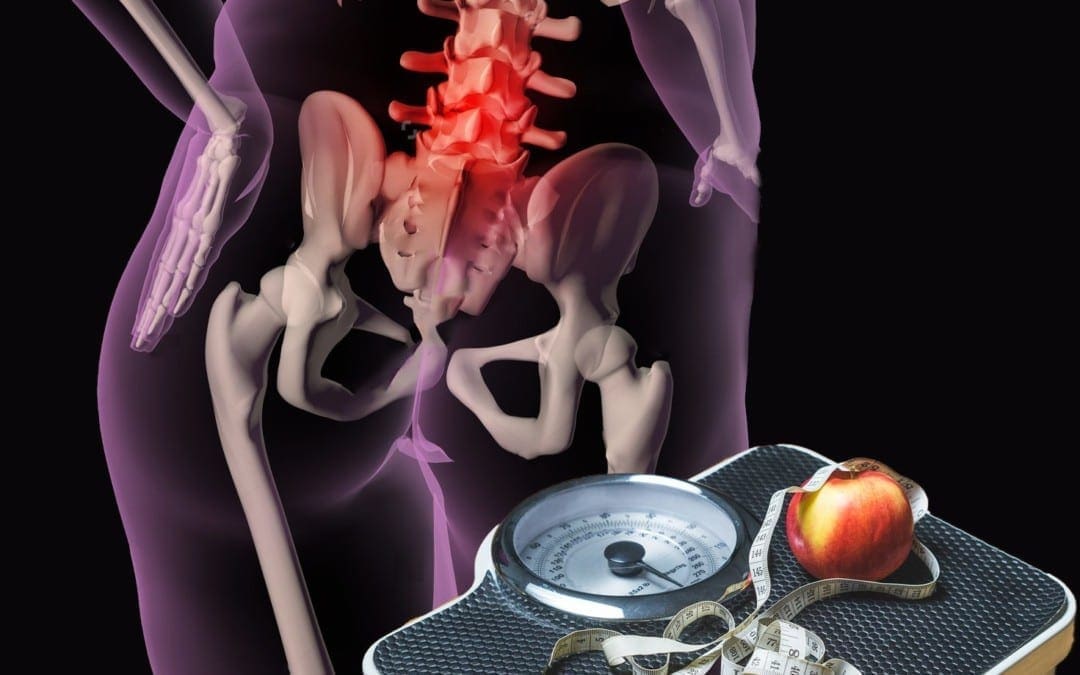 Weight Loss: Back Pain & Obesity