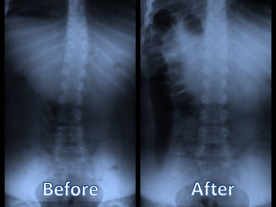 chiropractic benefits el paso tx.