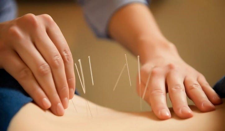 Alternative Treatment Options for Sciatica in El Paso, TX