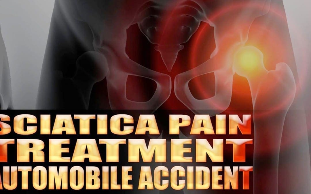 Sciatica Pain Treatment In El Paso, TX Chiropractic Care | Video
