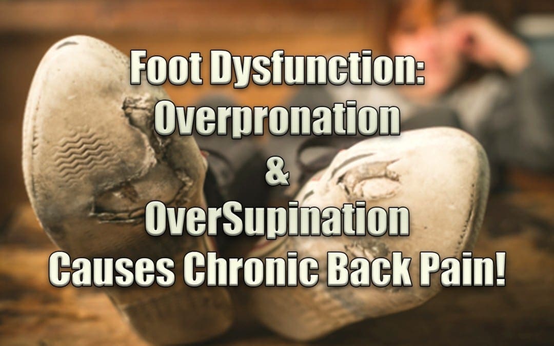 Foot Dysfunction: Over Pronation & Supination Causes Chronic Back Pain