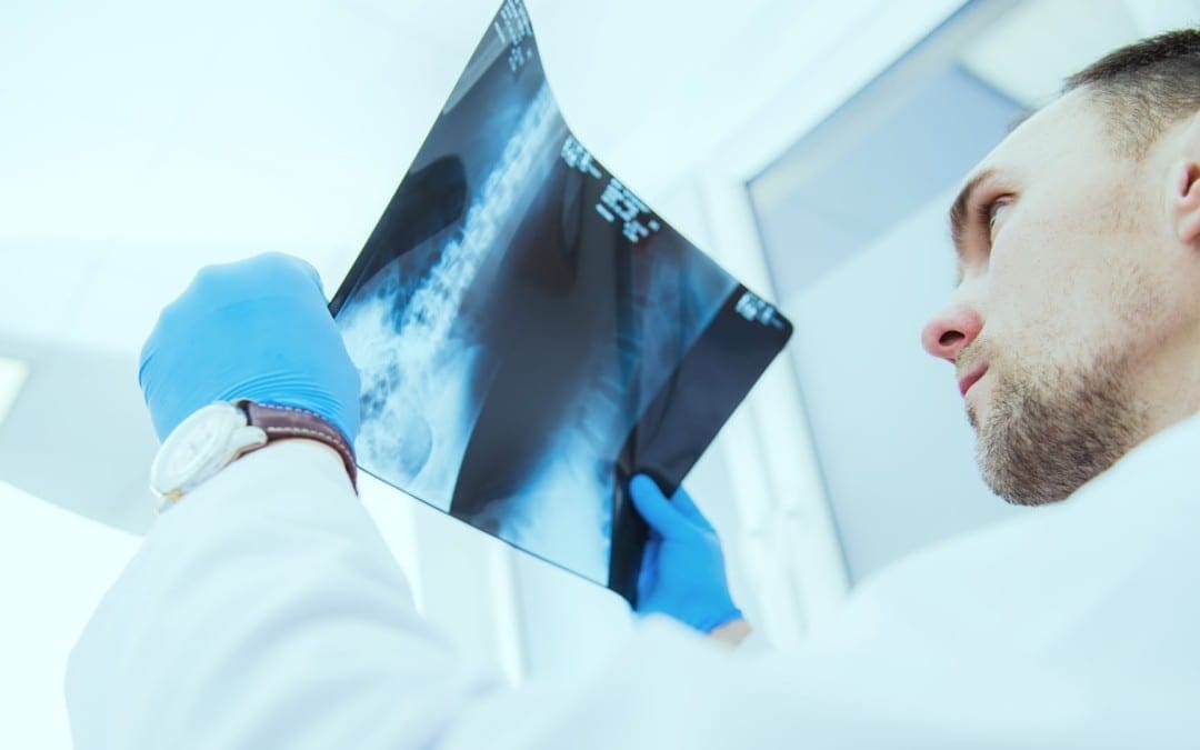 diagnosis hip arthritis and neoplasms el paso, tx.