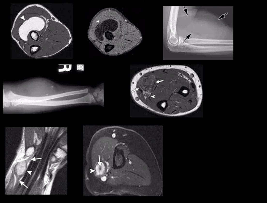 elbow imaging el paso tx.