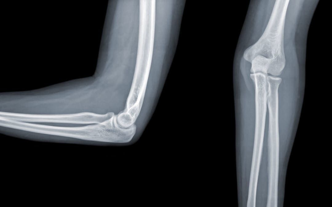 elbow imaging el paso tx.