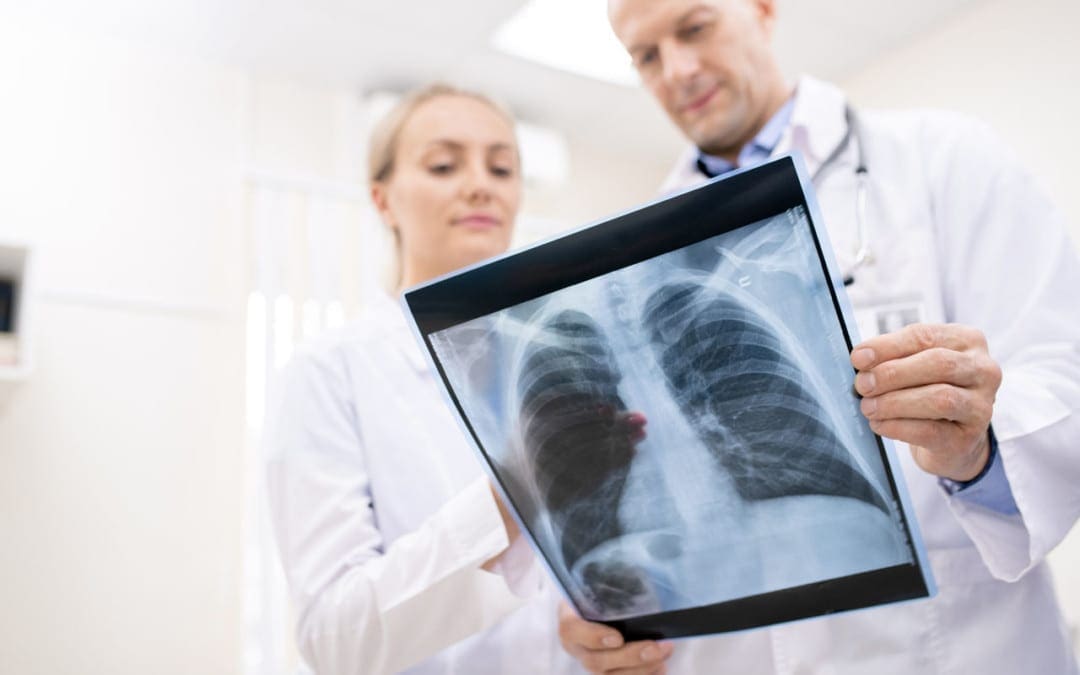 Spinal Tumor Type Overview