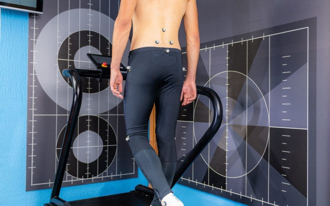 Trendelenburg Gait