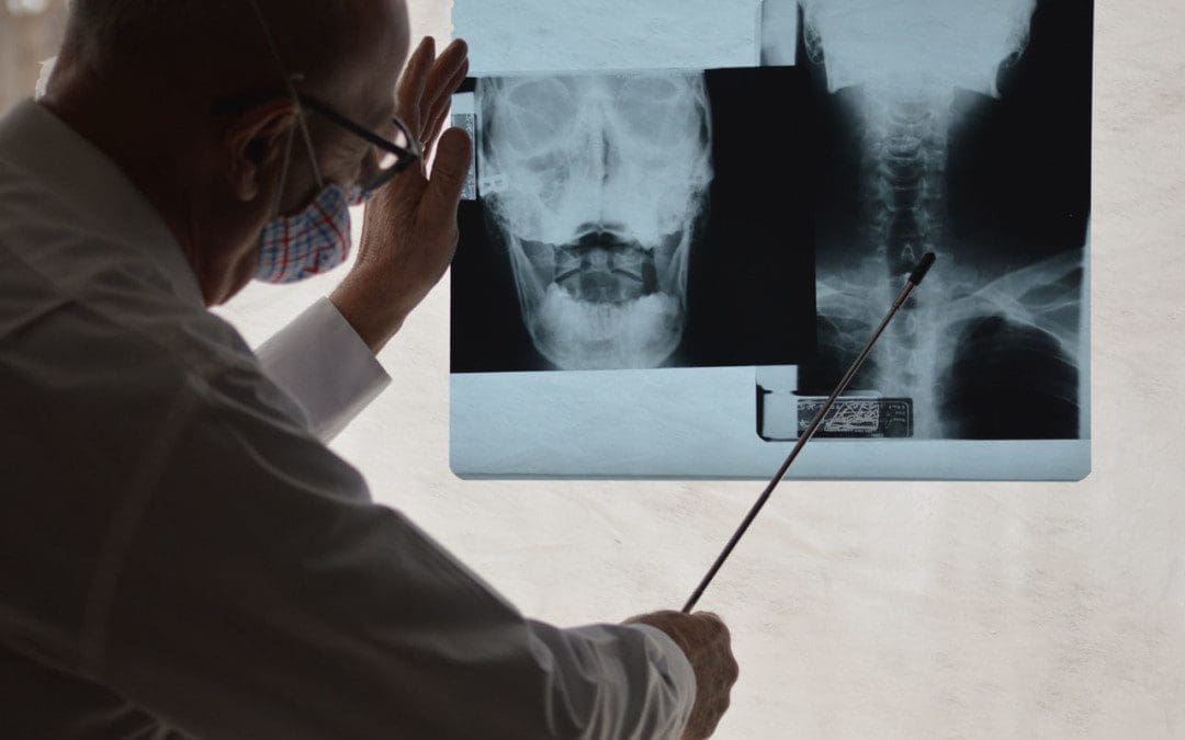 Syringomyelia Spinal Cord Disorder