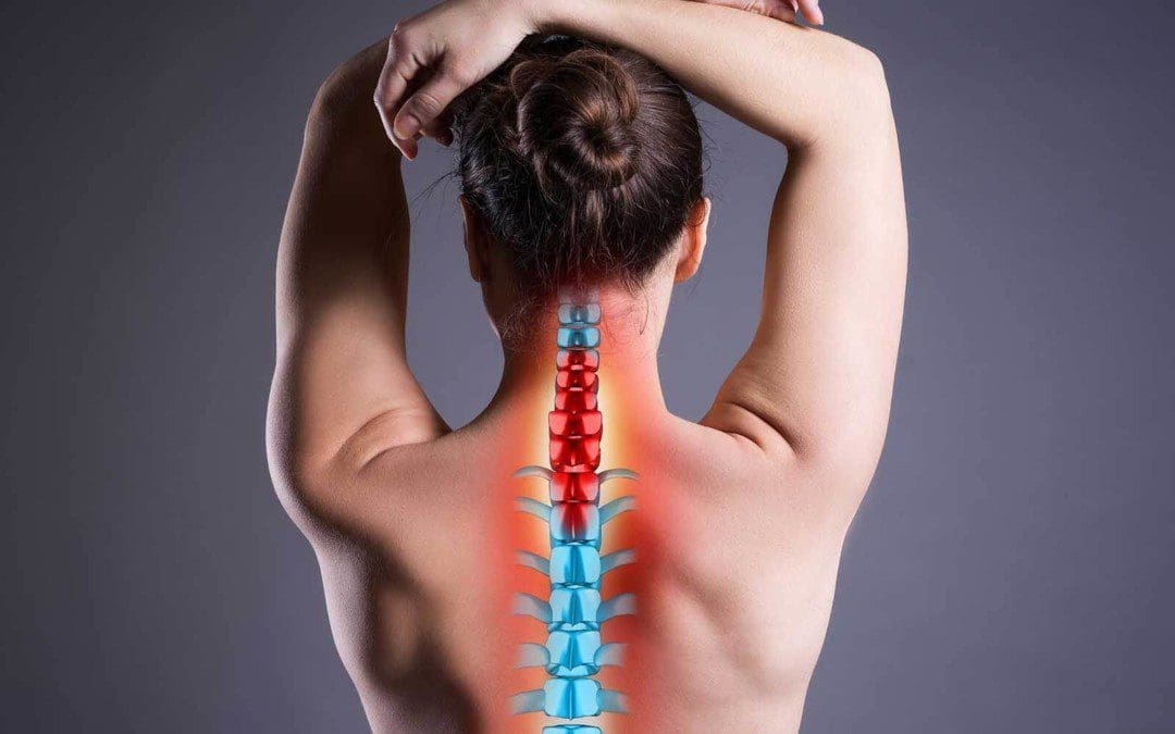 Treating Radiculopathies Using Spinal Decompression Therapy