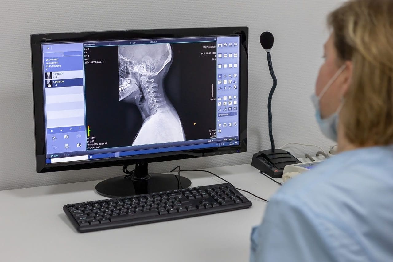 Integrated Chiropractic Accident Treatment for Recovery