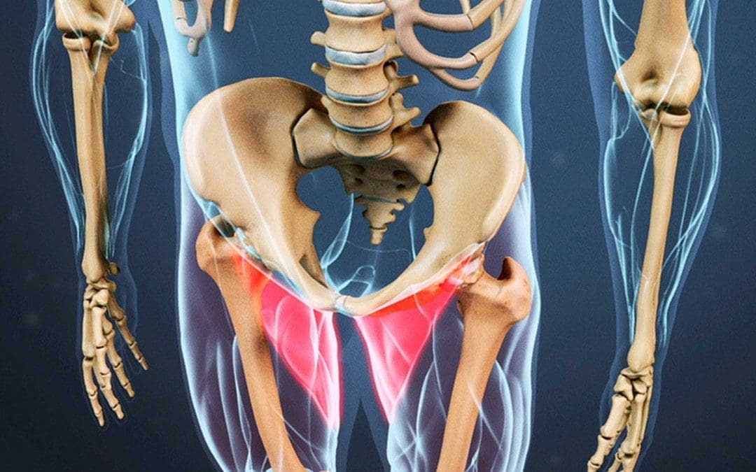 Groin Strain & The MET Technique