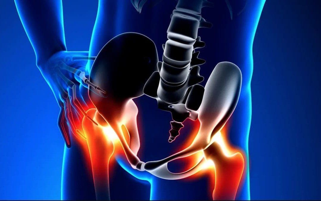 Assessing Hip Flexors With MET Therapy