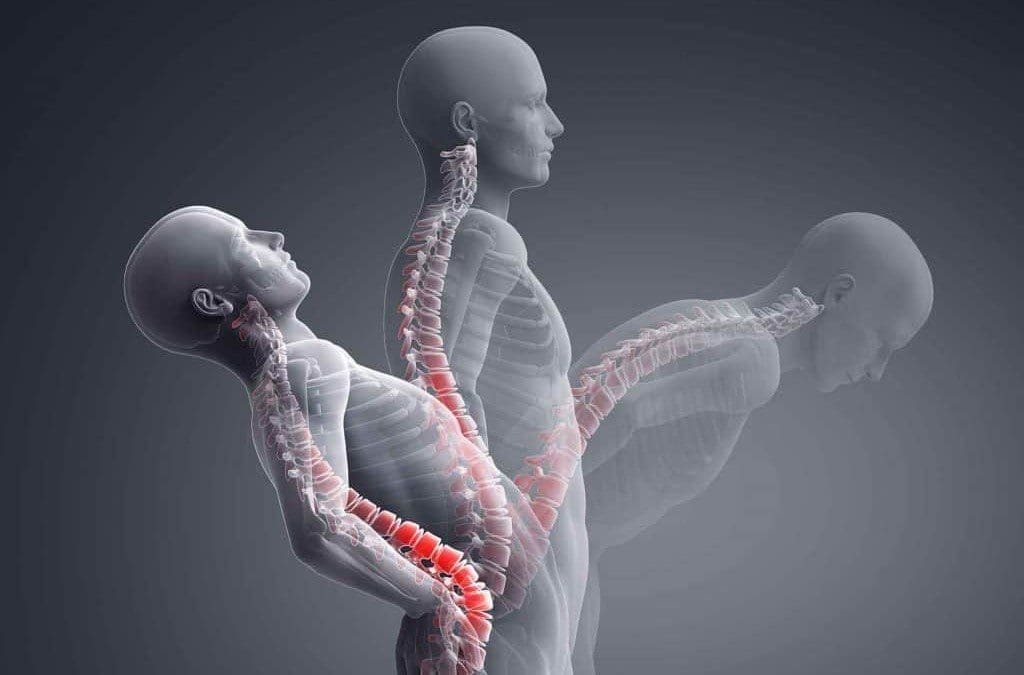 Facet Syndrome Protocols For Spinal Decompression