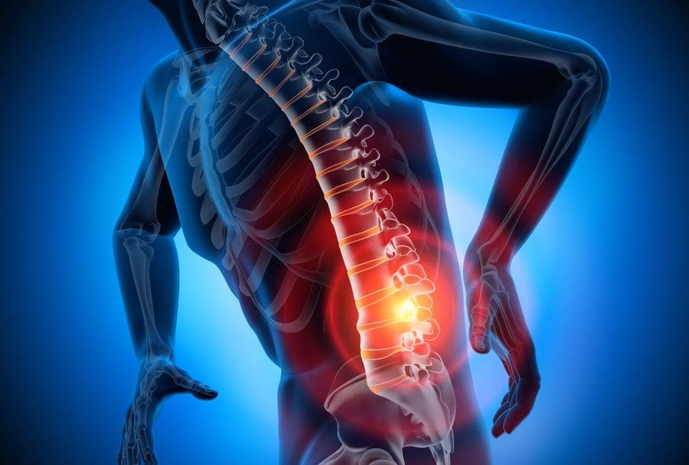 Intervertebral Disc Stress Relieved By Decompression