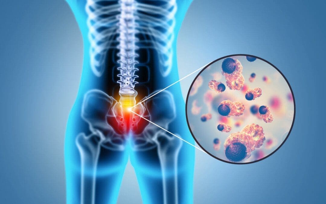 Addressing Painful Lumbar Degenerative Disorder: Easy Solutions