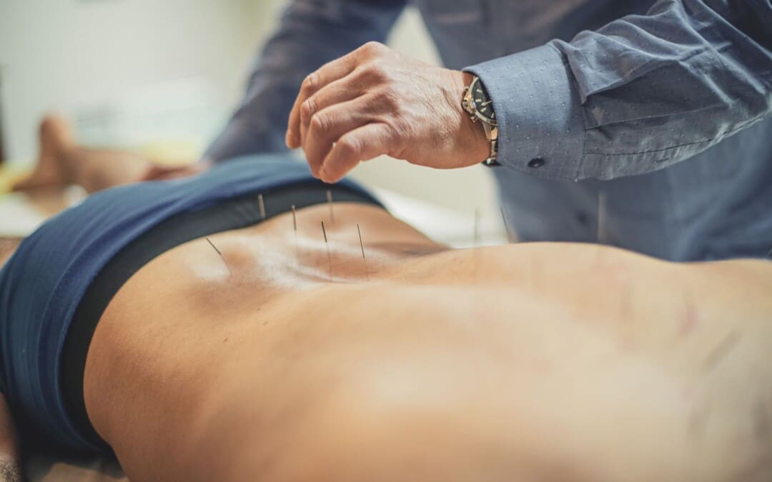 Easy Sciatica Pain Relief with Acupuncture Techniques