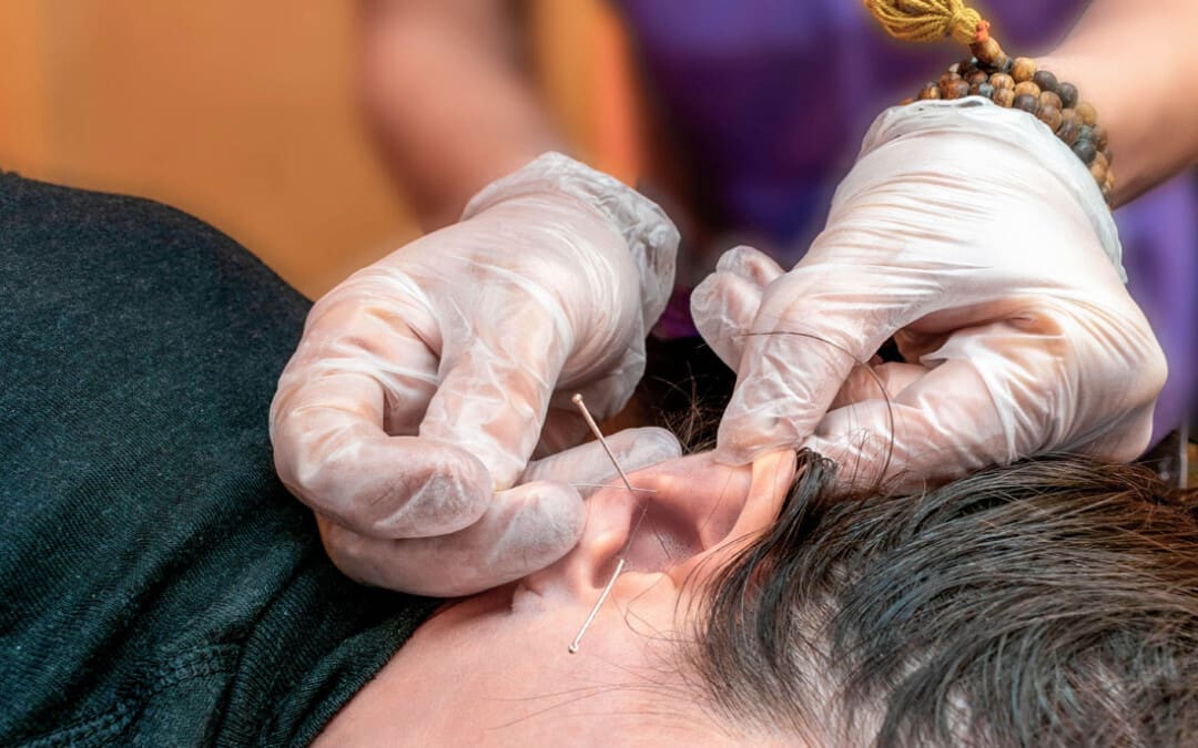 Discover the Benefits of Acupuncture for Weight Loss