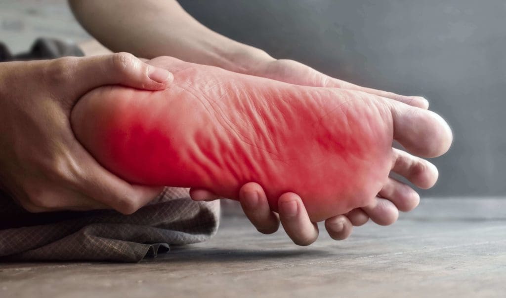Preventing and Treating Plantar Fasciitis with Various Stretches