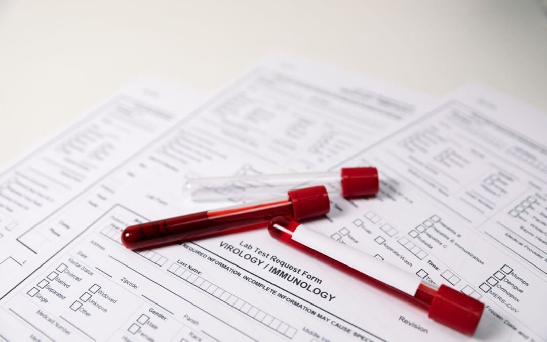 Diagnostic Value of Blood Tests for Back Pain